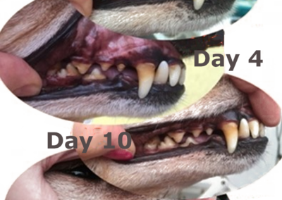 14 Day Teeth Cleaning